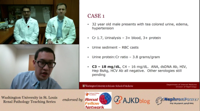 Youtube Nephrology Teaching Episode #5 Published