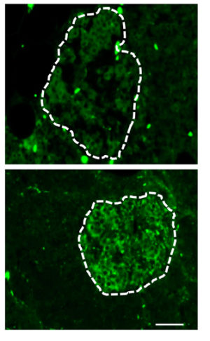 photo_cellules_beta (1)