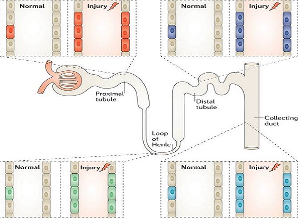 Cellular Plasticity in Kidney Injury and Repair