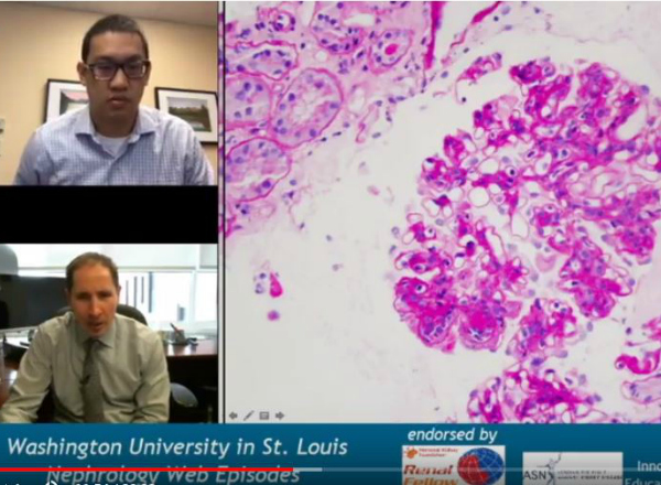40K and Counting! Nephrology Web Series
