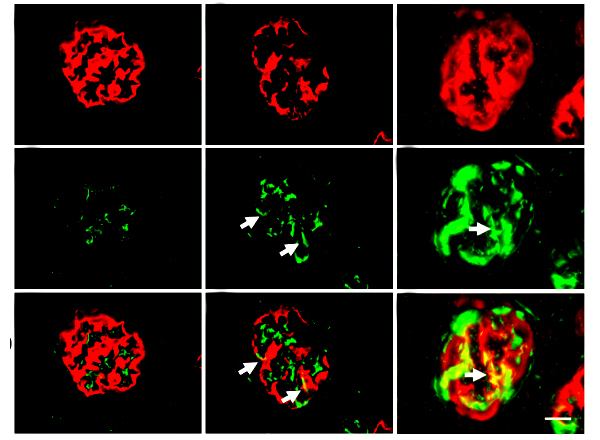 Maggie Chen Awarded $1.52M NIH R01 Grant to Study Nephrotic Syndrome