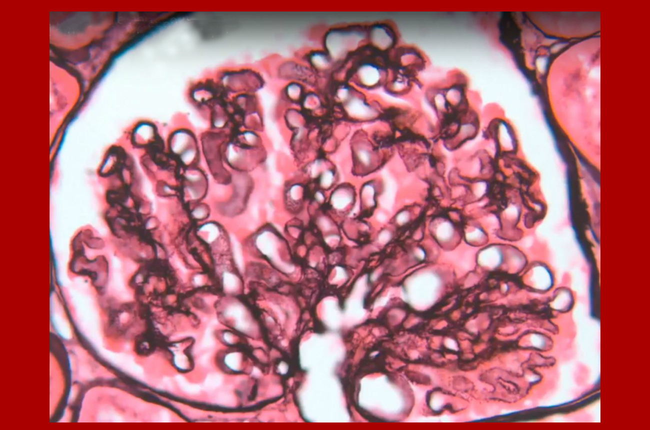 Yau’s New Podcast Format Merges Nephrology, History and Storytelling