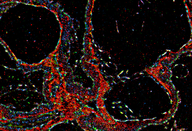 Suleiman and Alhamad Awarded WU Nephrology 2017 Translational Innovation Grant