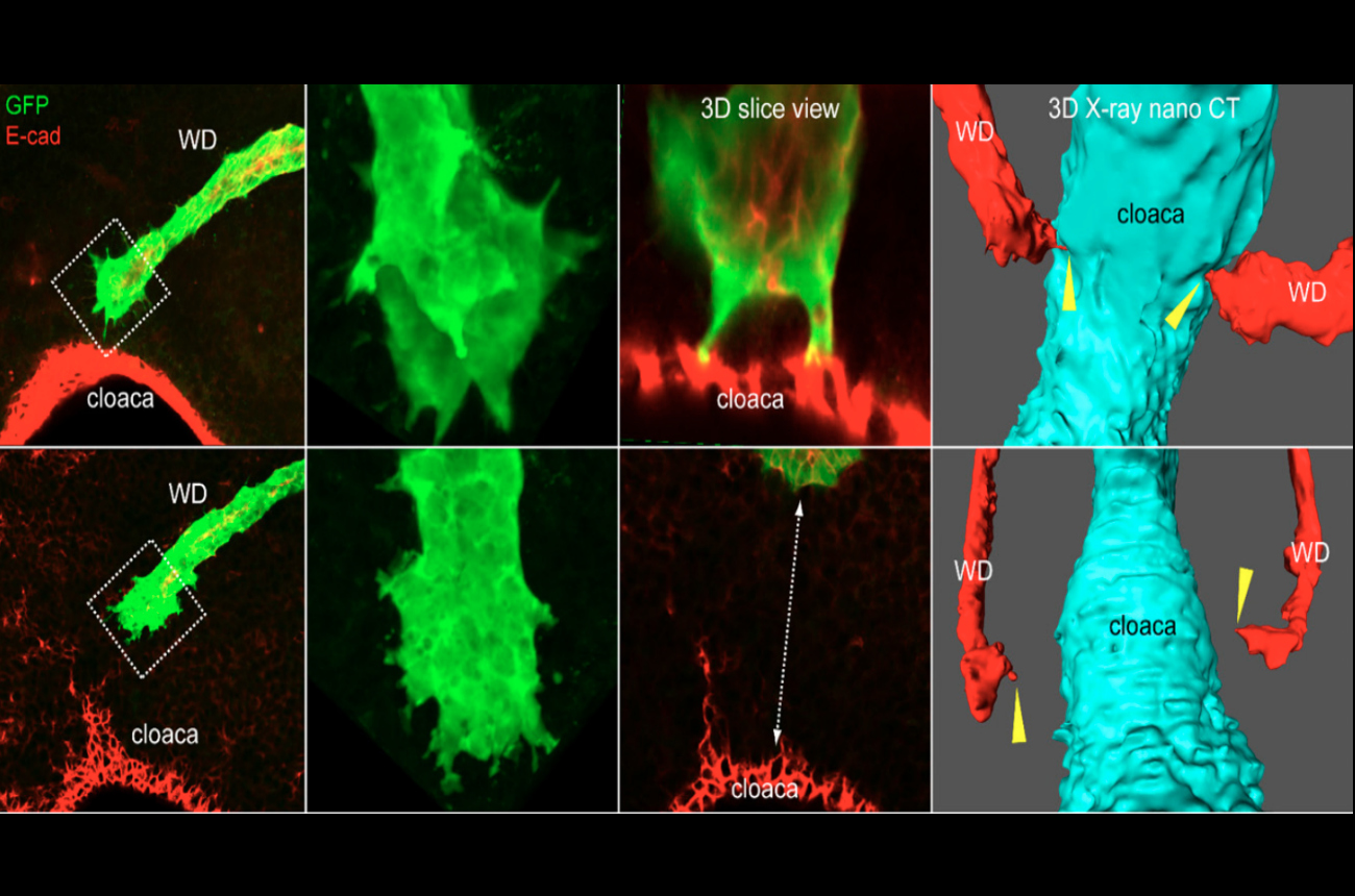 The Kiss of Life and Death in the Making of the Kidney and Urinary Tract