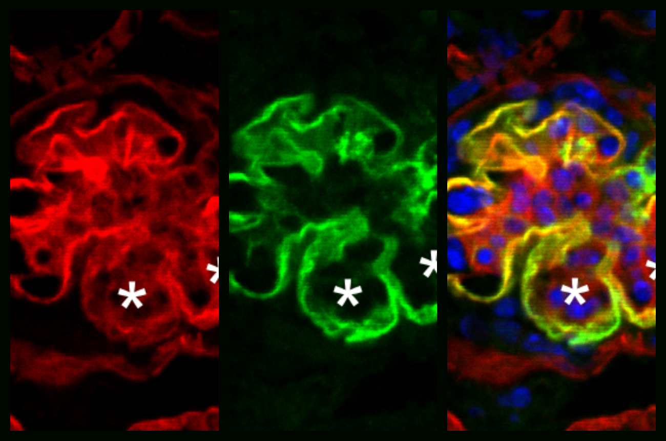 Meei-Hua Lin’s Eye-Catching Image is JASN’s New Cover