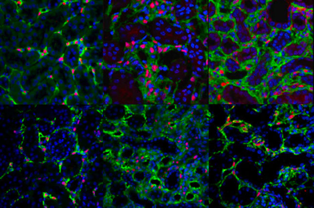 Meis1 in Kidney Aging and Injury – Unexpected Findings