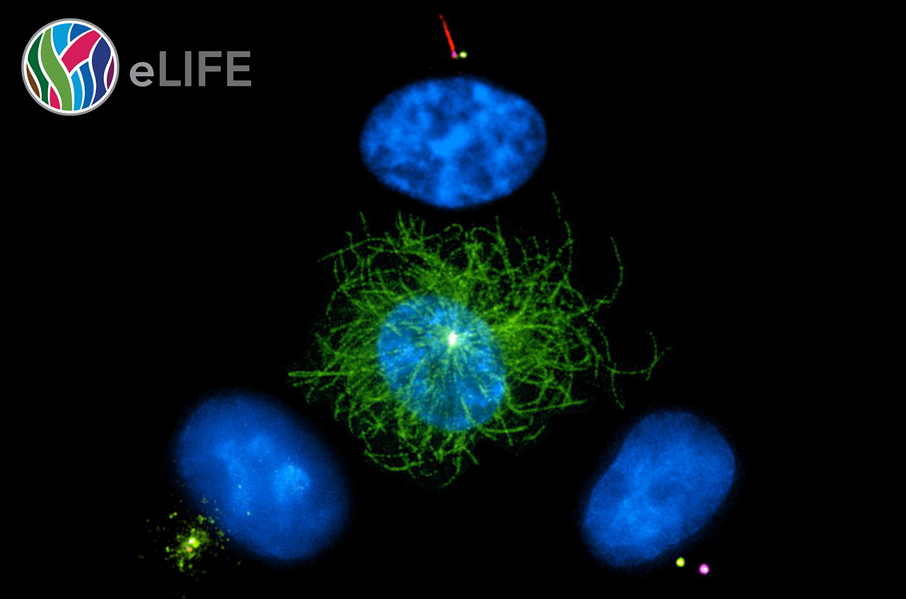 Study Defines a Novel Molecular Defect Underlying Renal Cystogenesis