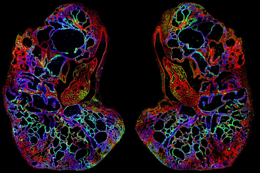 Too Many Centrosomes Spoil the Kidney