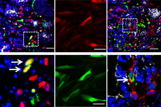 Gene Therapy Study Using AAV-based Vectors Lays Foundation for Kidney Fibrosis Treatment
