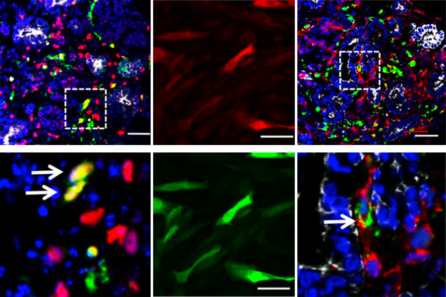 Gene Therapy Study Using AAV-based Vectors Lays Foundation for Kidney Fibrosis Treatment