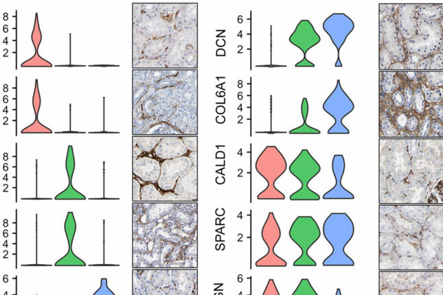 scRNA-seq is a Game Changer in Kidney Biopsy Cell Characterization