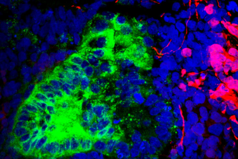 Refining the Recipe to Turn Stem Cells into Kidney Cells