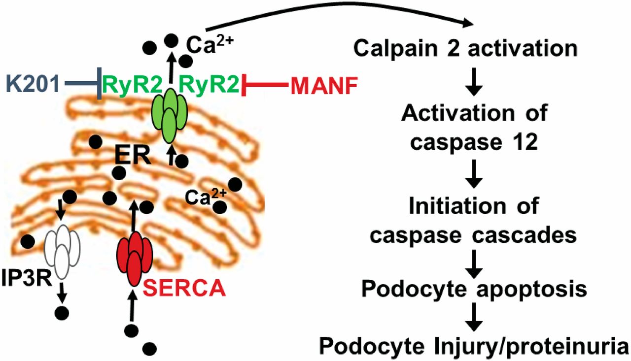 Promising Therapies for the Treatment of Podocyte Endoplasmic Reticulum Stress-induced NS/FSGS