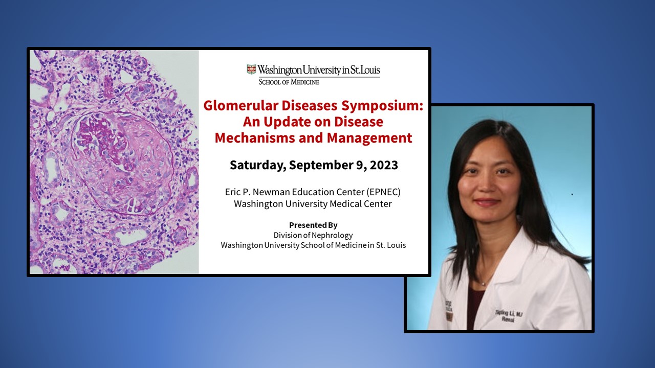Dr. Tingting Li to Chair Inaugural WashU Nephrology Glomerular Diseases Symposium